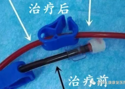 三氧自血療法可以治療什么疾?。? /></a>
						</div>
						<p><a href=
