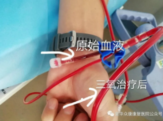 秋天腦血管疾病高發(fā)期，做對(duì)一件事就高枕無憂了